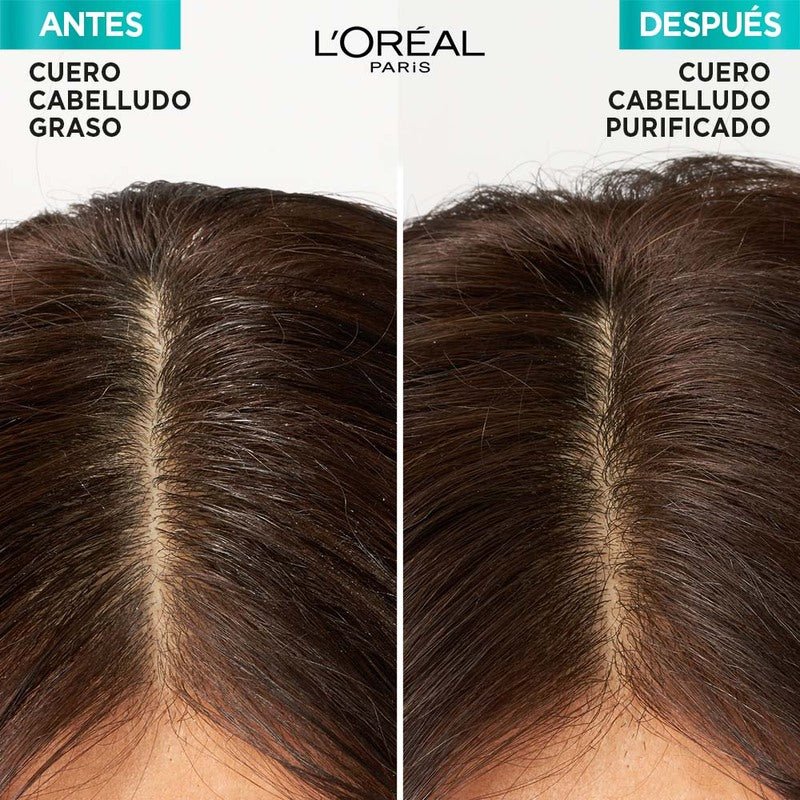 L'Oreal ElVive Acondicionador Hidra Hialurónico Pure 370Ml - Farmacias Arrocha