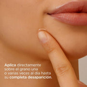ISDIN Acniben on the Spot - Gel secante 15 ML - Farmacias Arrocha