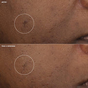 Clinique Crema Hidratante Even Better Clinical™ Antimanchas 15 ml - Farmacias Arrocha