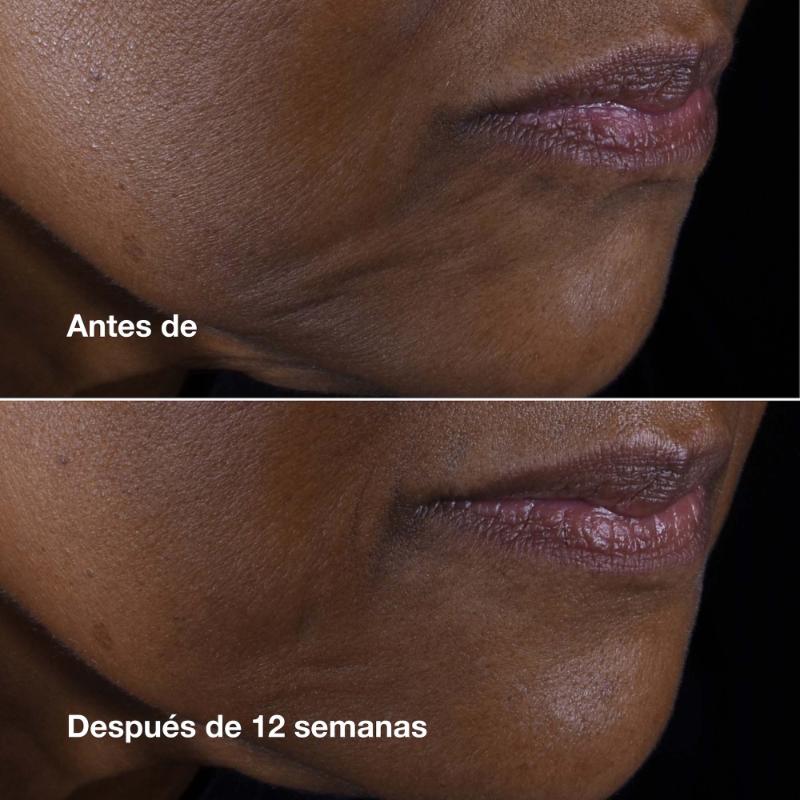 Clinique Crema Humectante Smart Clinical Repair™ Lift Rostro Y Cuello Antiedad 50 Ml - Farmacias Arrocha