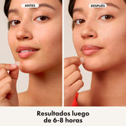 Hero Mighty Patch Original Parches Para Acné 24 Unds - Farmacias Arrocha