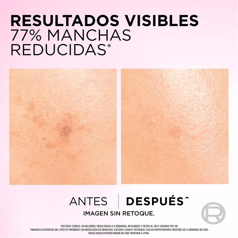 Sérum Facial L'Oréal Paris Glycolic Bright antimanchas Ácido Glicólico y Niacinamida 30 - Farmacias Arrocha