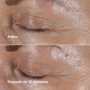 Clinique Crema Contorno De Ojos Smart Clinical Repair™ Antiarrugas 15 Ml - Farmacias Arrocha