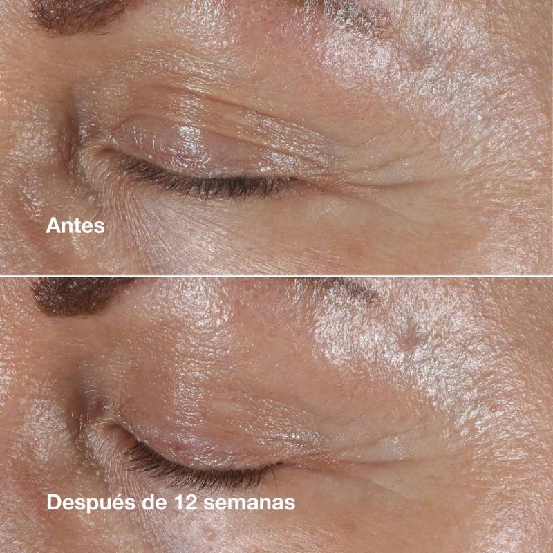 Clinique Crema Contorno De Ojos Smart Clinical Repair™ Antiarrugas 15 Ml - Farmacias Arrocha
