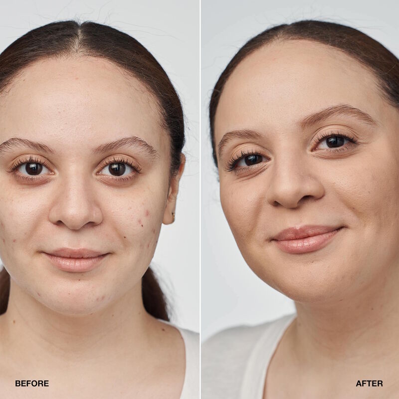 Clinique Base De Maquillaje y Suero Even Better Clinical™  SPF 20 30Ml - Farmacias Arrocha